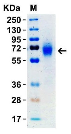 Novus Biologicals Recombinant SARS-CoV-2 Spike (RBD+SD1+SD2) His (C-Term) Protein 0.05 mg | Buy Online | Novus Biologicals&trade; | Fisher Scientific